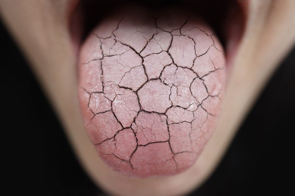 舌の絵