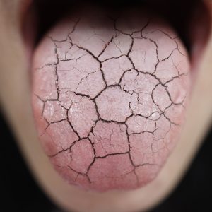 舌の絵